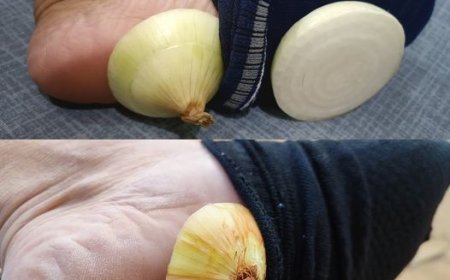 Warum Zwiebeln