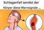 Schlaganfall symptome: Was sind die Warnsignale?