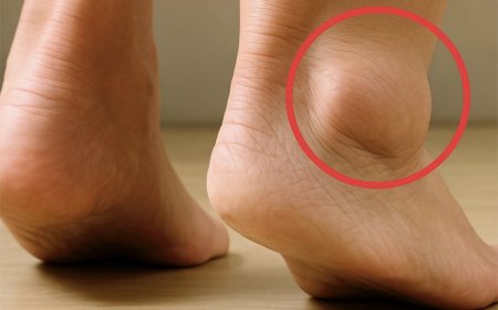 Geschwollene Füße: Was sind die Anzeichen und Lösungen