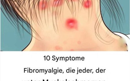 10 Symptome von Fibromyalgie, die jeder mit Muskelschmerzen lesen sollte