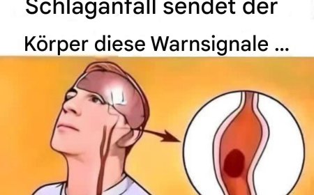 Schlaganfall symptome: Was sind die Warnsignale?