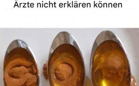Zimt und Honig: Das stärkste Heilmittel, das selbst Ärzte nicht erklären können