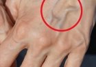 Natural Remedies to Improve the Health of Your Veins and Skin
