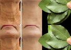 Bay Leaf Is 100,000 Times Stronger Than Botox? | Natural Wrinkle Eraser Even at Age 70!