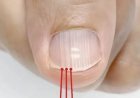 If you have these lines on your nails after 40, it is a clear sign that