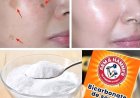 4 Ways to Erase Age Spots with Baking Soda for Younger, More Even Skin