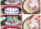 RAPID TEETH WHITENING in 1 minute!