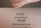 If You Suffer from Poor Circulation and Your Legs Feel Like This, Here’s the Solution