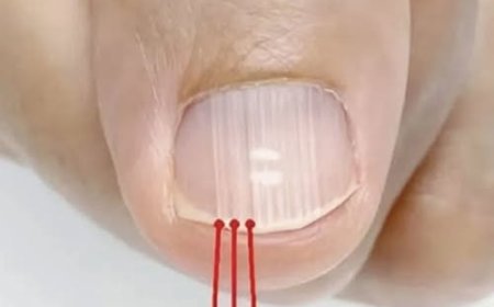 If you have these lines on your nails after 40, it is a clear sign that