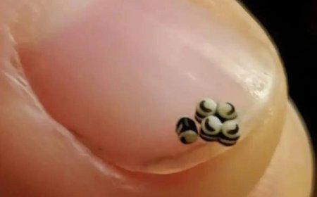 We ordered a salad, but there were tiny black specks in the food – we went straight to the hospital