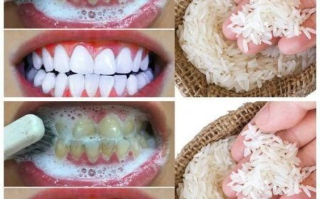 RAPID TEETH WHITENING in 1 minute!