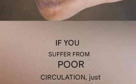 If You Suffer from Poor Circulation and Your Legs Feel Like This, Here’s the Solution