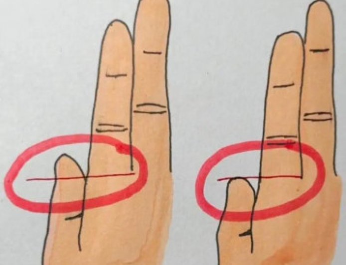 Your Fingers Could Reveal Whether You’re Rich or Poor