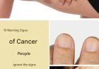 15 Warning Signs of Cancer People Ignore Until It's Too Late