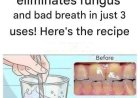 Remove tartar from your teeth and whiten them with this simple recipe.