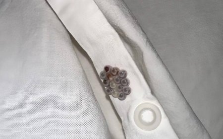 I found these little marbles in my bed and almost had a heart attack