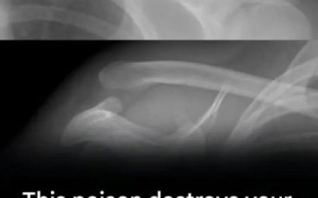 This drink is ruining your bones from the inside out, yet everyone is drinking it.