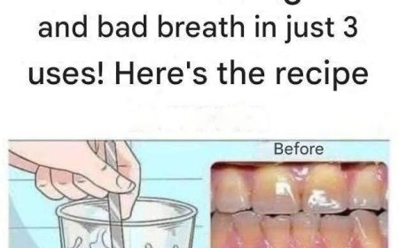 Remove tartar from your teeth and whiten them with this simple recipe.
