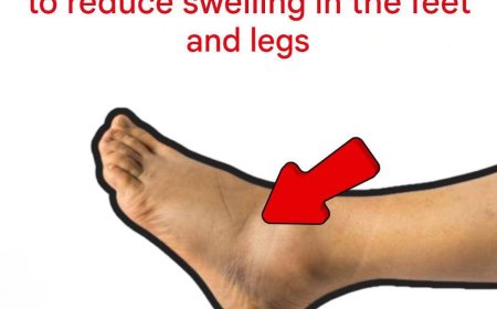 The 5 best nutrients to reduce swelling in the feet and legs