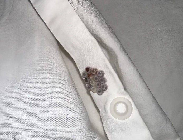 I found these little marbles in my bed and almost had a heart attack