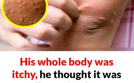 His whole body was itchy, he thought it was an allergy and was diagnosed