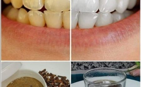 Teeth Whitening: 7 Proven Methods to Permanently Eliminate Yellow Teeth!