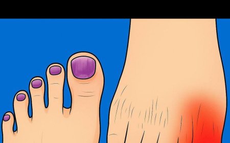 Signs of Kidney Disease in the Feet