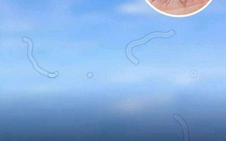 Eye floaters: what they are and what to do if you notice them, according to an eye doctor