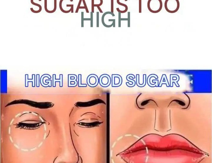 The High Sugar Alert: Recognizing the 12 Key Symptoms Your Body is Showing You.