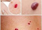 Small Red Dots on the Skin: What They Often Mean and When to Pay Attention