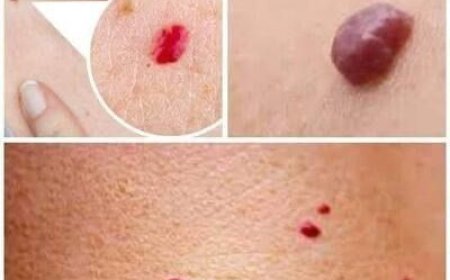 Small Red Dots on the Skin: What They Often Mean and When to Pay Attention