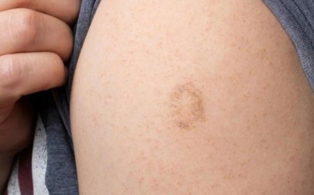 Here's The Truth Behind This Scar On People's Upper Left Arm