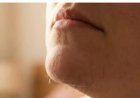What Chin Hair in Women Really Says About Horm:ones