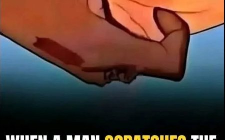 The Meaning of the Intriguing Gesture of Scratching the Palm of Another Person’s Hand