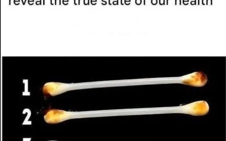 Our ears reveal the true state of our health