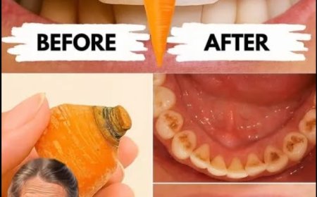 Sparkle Like Never Before: Brighten Your Smile in 2 Minutes with Natural Teeth Whitening Hacks