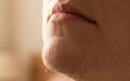 What Chin Hair in Women Really Says About Horm:ones