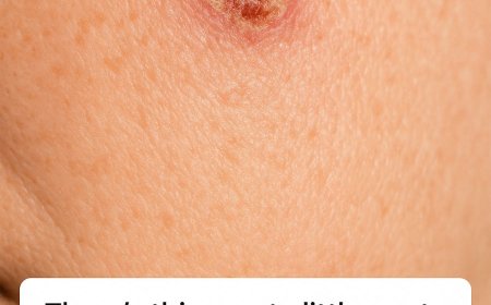 The Crusty Spot That Won’t Heal: What Your Skin May Be Trying to Tell You