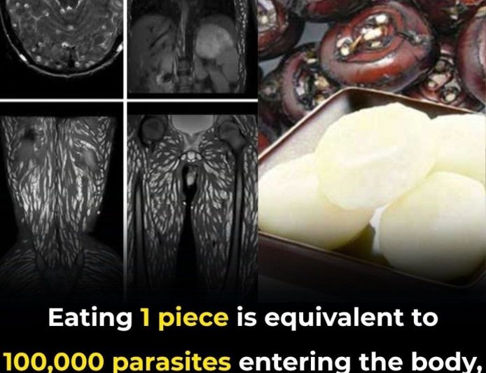 Eating Just One Bite Can Be Harmful: How to Protect Yourself from Foodborne Parasites