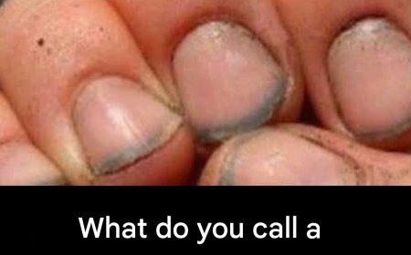 What do you call a person who has nails like that?