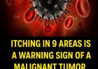9 Areas Where Persistent Itching Might Signal a Serious Health Issue