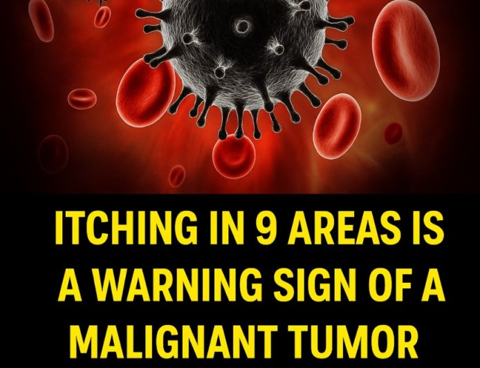 9 Areas Where Persistent Itching Might Signal a Serious Health Issue
