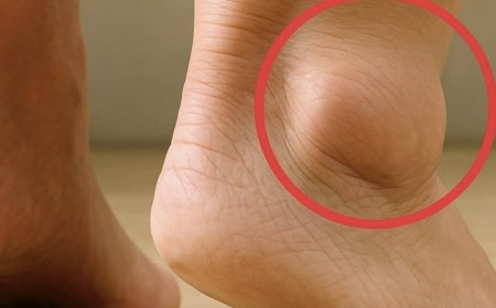 Wenn Ihre Füße anschwellen, ist das ein deutliches Zeichen dafür, dass…